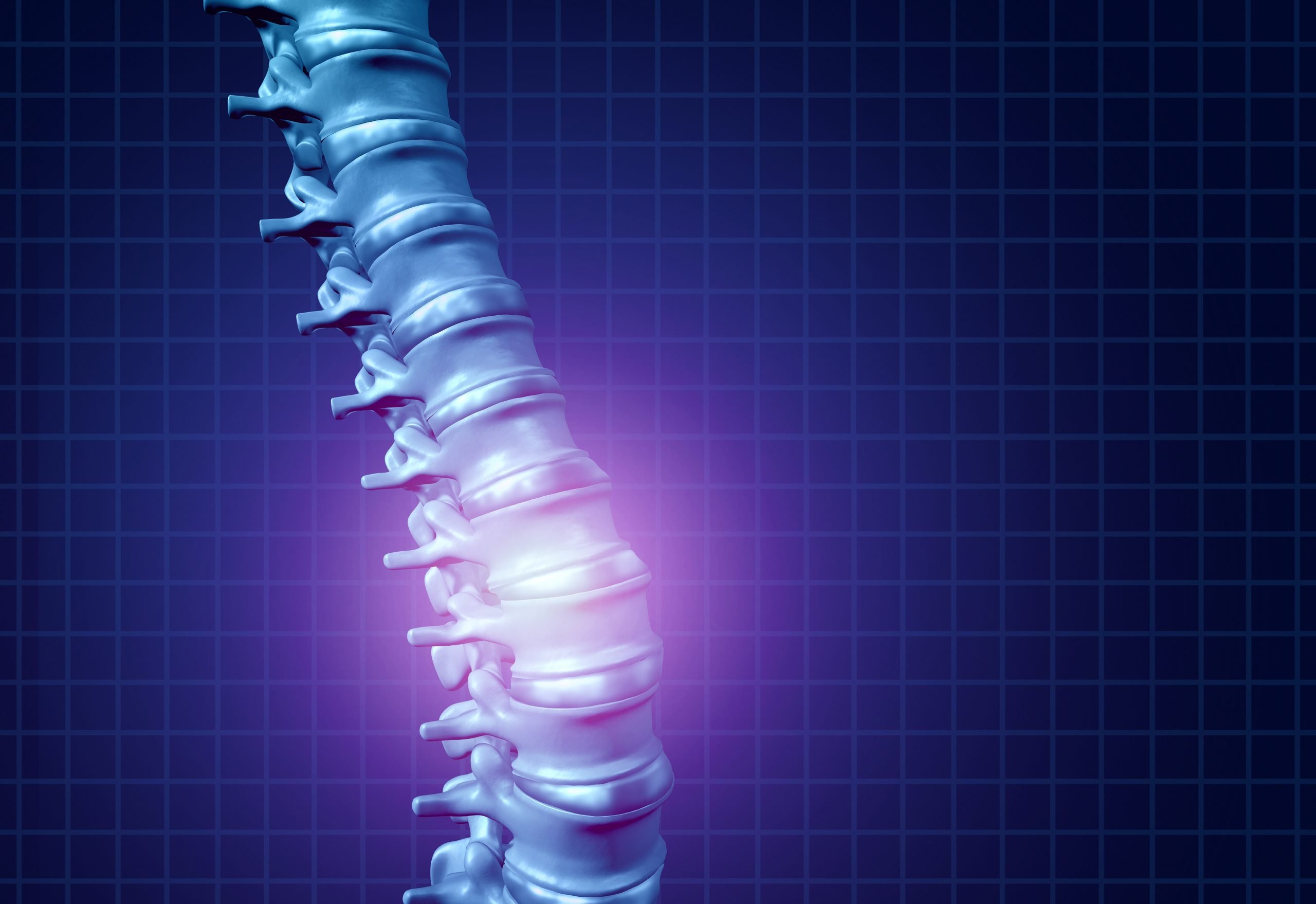 Spinal Cord Stimulators in Denver MD Pain