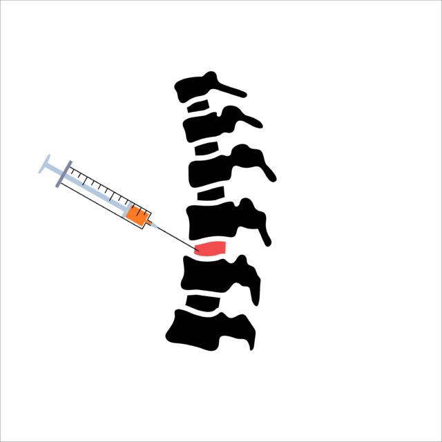 Drawing of a Needle Injection Spot on a Spine