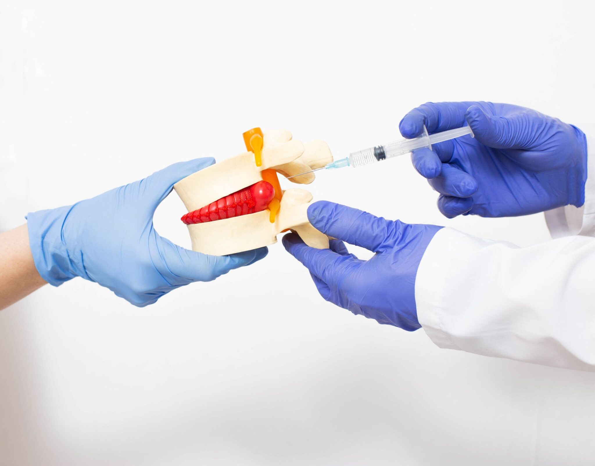 Medial Injection Medial Branch Block in Denver - MD Pain