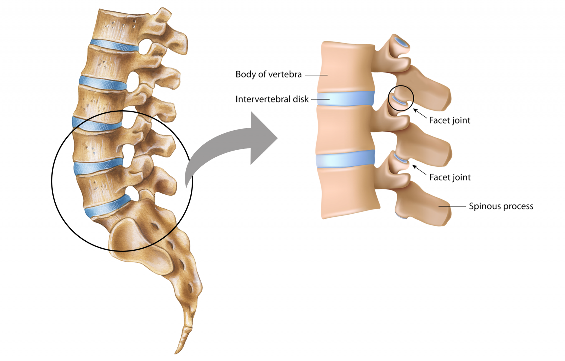 Facet Joint Pain Specialists in Denver MD Pain