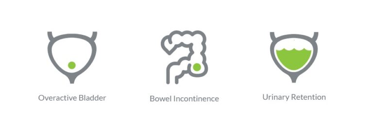 Axonics Therapy For Bladder And Bowel Incontinence